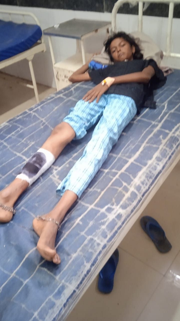 साखरी येथे माकडाचा हल्ला  १३ वर्षीय मुलगी गंभीर जखमी   अंजनगाव तालुक्यातील साखरी येथील घटना