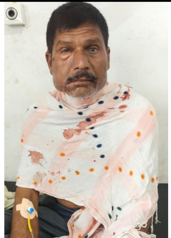 शेतामध्ये पाणी सोडण्यात गेलेल्या शेतकरी बिबट्याच्या हल्ल्यात जखमी