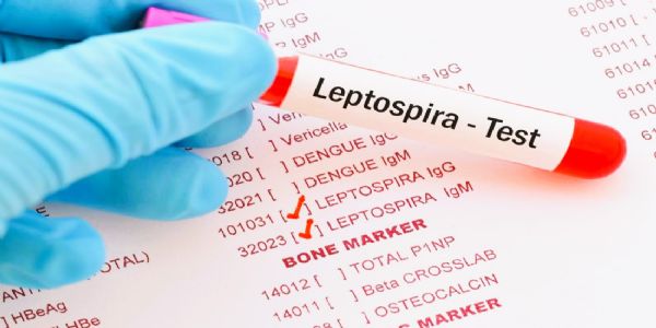 केरळमध्ये लेप्टोस्पायरोसिसचा कहर, केंद्र सरकारकडून अलर्ट जारी