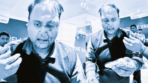 जखमी प्रवाशाचा व्हायरल फोटो