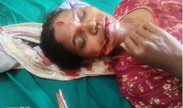 महिला गंभीर जखमी