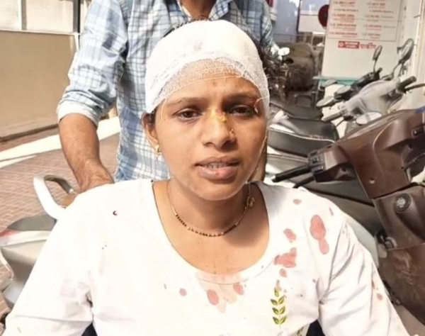 भातकुली पंचायत समितीत महिला परिचारिकेवर जीवघेणा हल्ला;  कर्मचाऱ्यांत भीतीचे वातावरण...