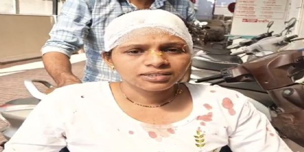 भातकुली पंचायत समितीत महिला परिचारिकेवर जीवघेणा हल्ला; कर्मचाऱ्यांत भीतीचे वातावरण