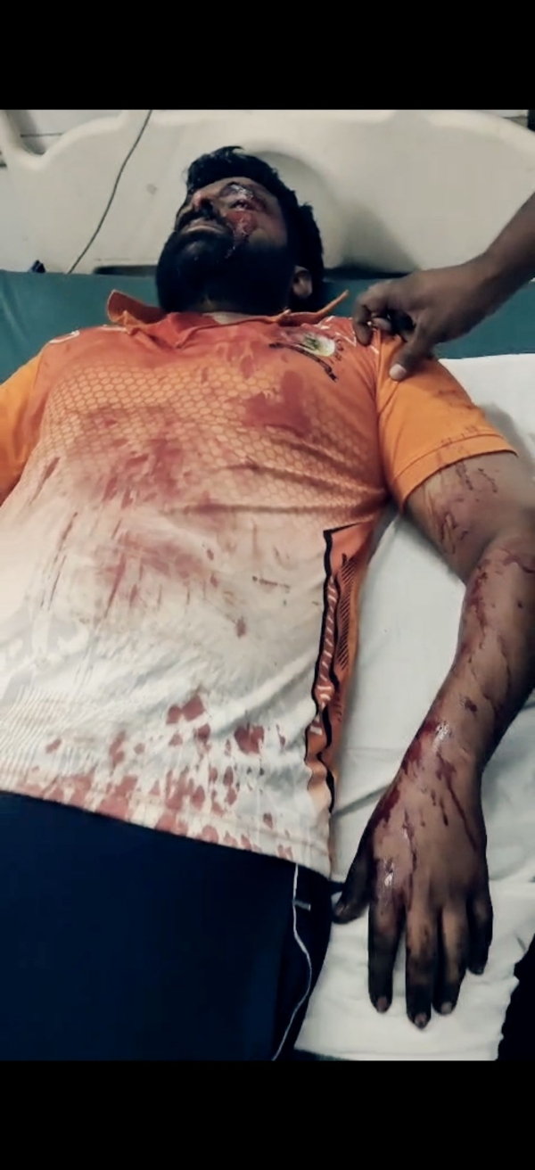 मारहाणीत गंभीर जखमी अहेरी नगरपंचायत अधिकारी वैभव पांढरे यांच्यावर दवाखान्यात उपचार