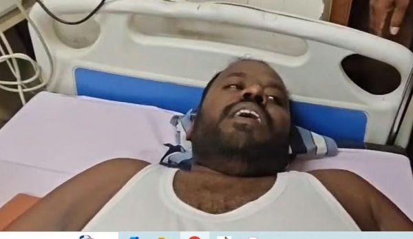 fgdf