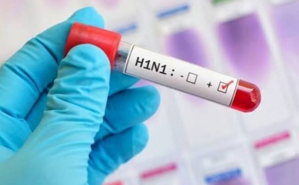 MP Swine Flu Another patient dies H1N1